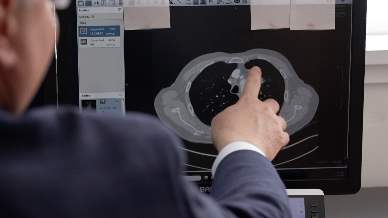 A physician point to an MRI on a computer screen.