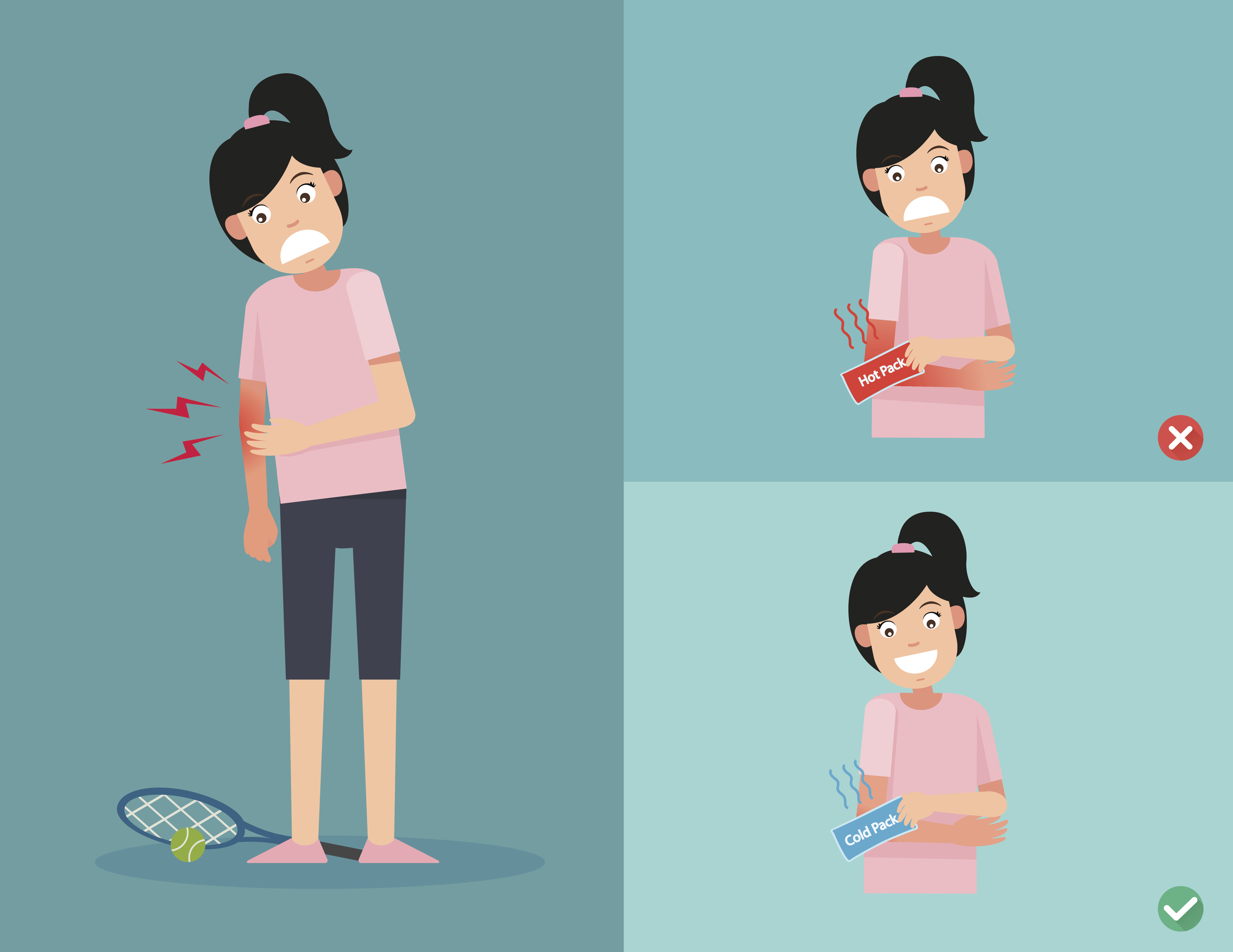 Graphic illustrating a pickleball player experiencing elbow pain that they help to care for by using a hot and cold compress on the area.