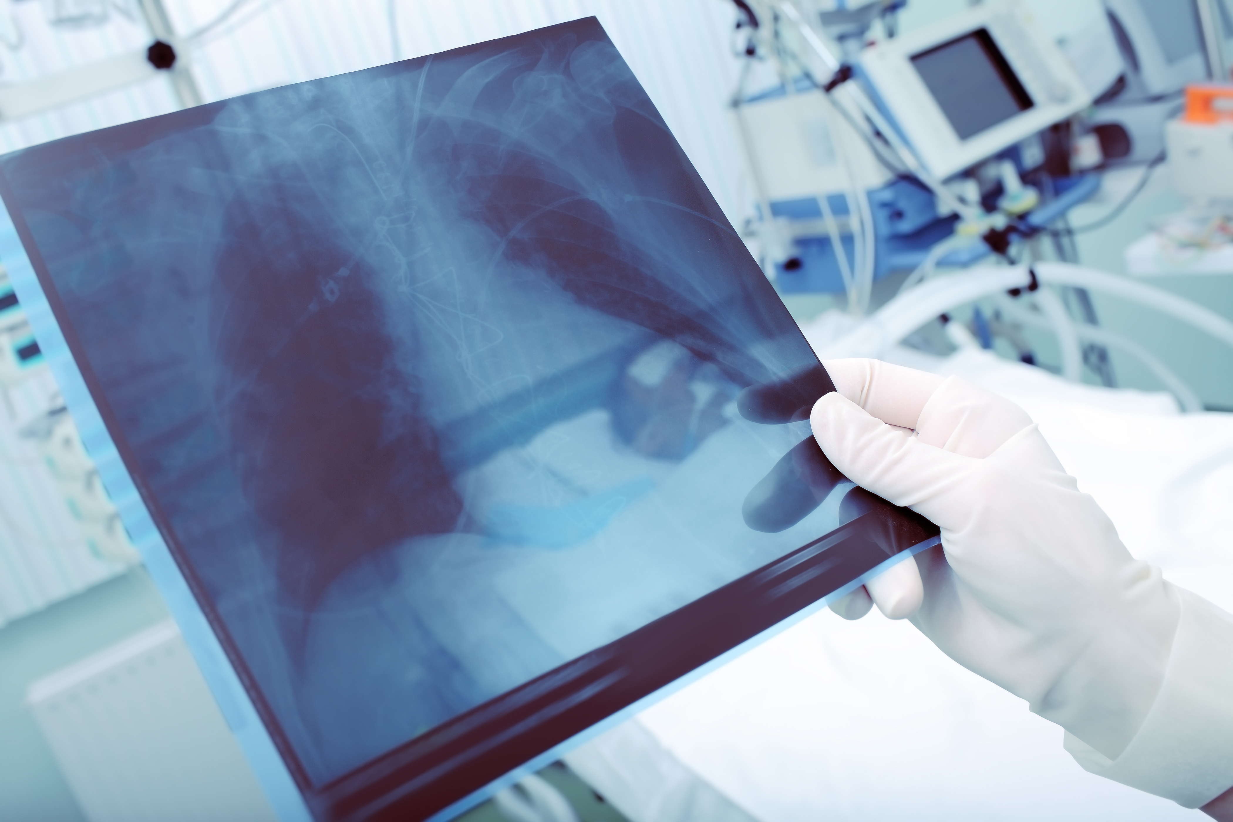 A physician reviews an image of a patient's lungs and chest.
