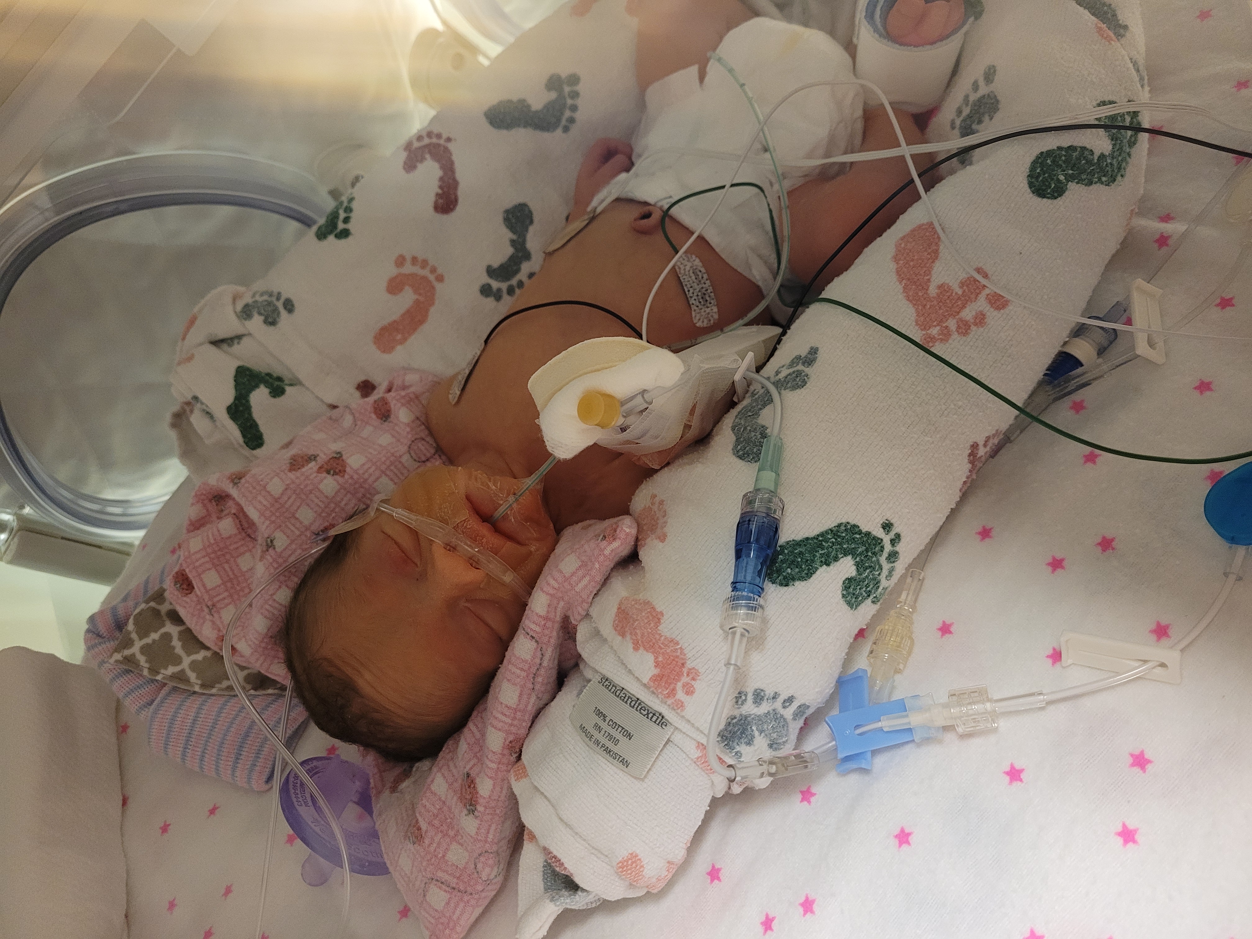 Baby in NICU.