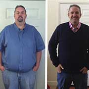 Before and after photos of weight loss surgery patient Matt Reichstein that show significant weight loss.