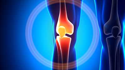 A 3D rendered image of a knee, the patella and surrounding area glowing bright red to indicate importance.