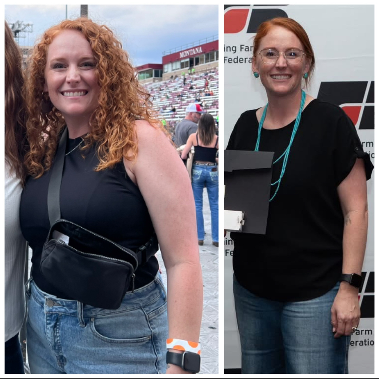 Cassie before and after her surgery