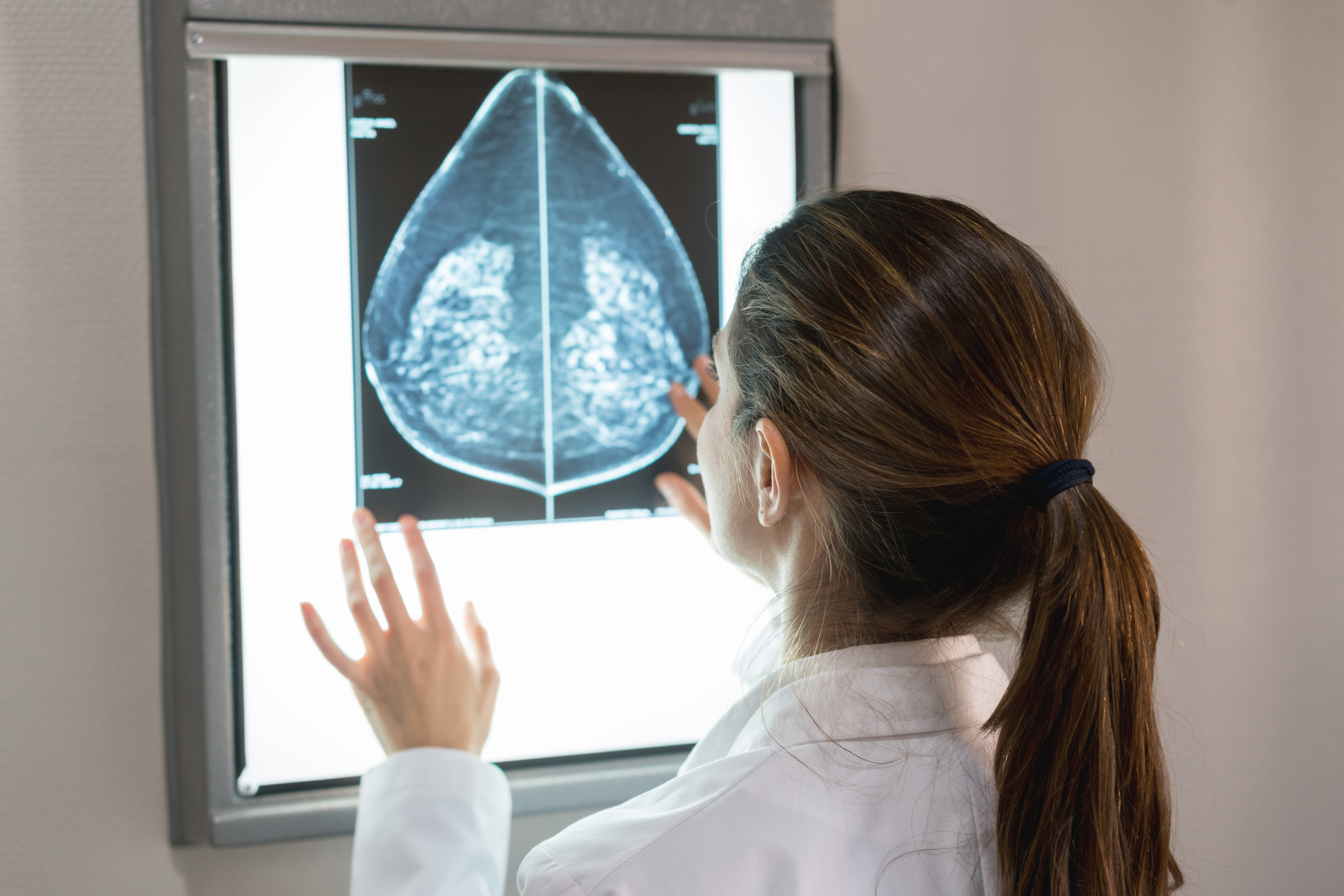 Doctor viewing x-ray on light panel.