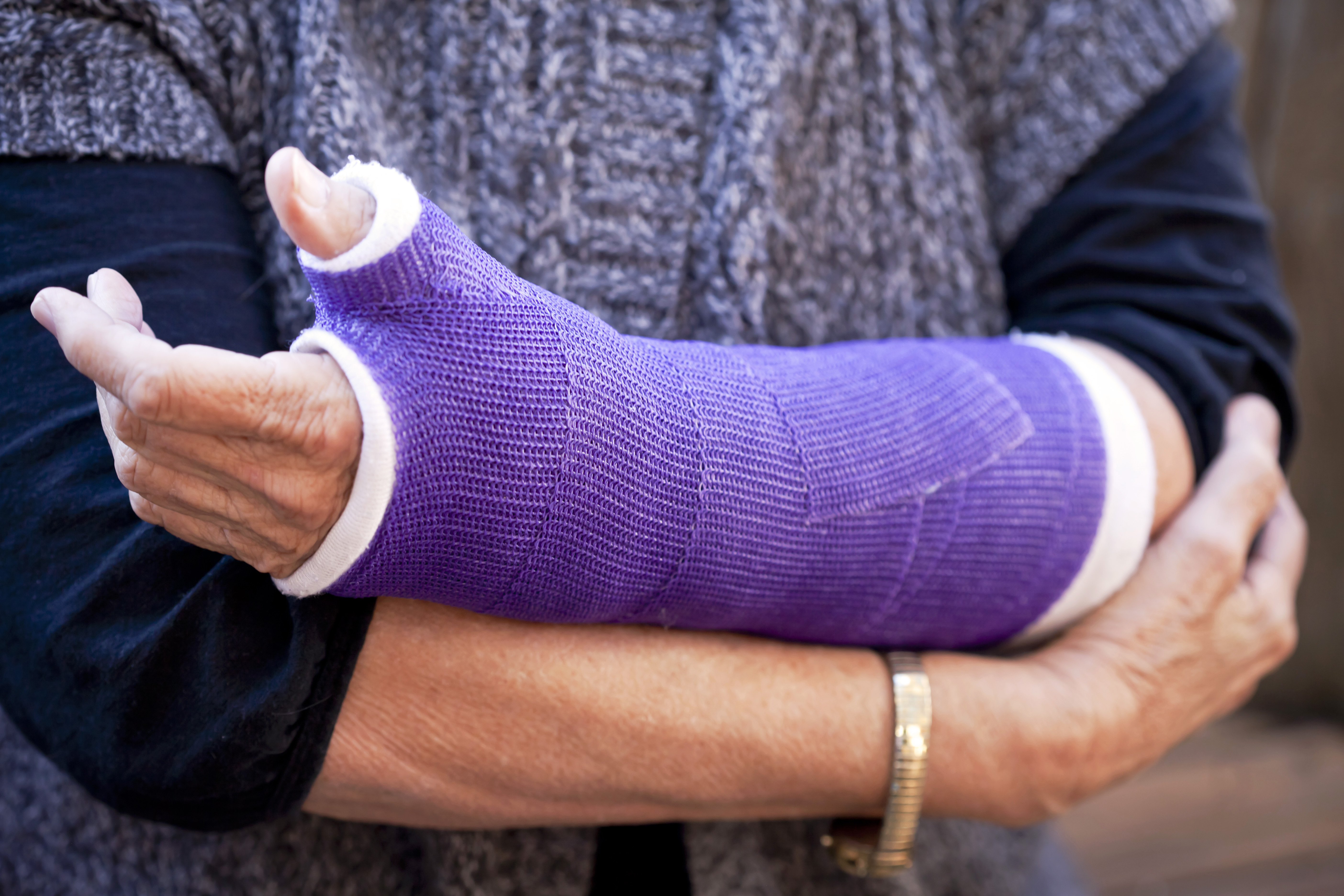 Midsection of woman holding her arm that is in a cast.