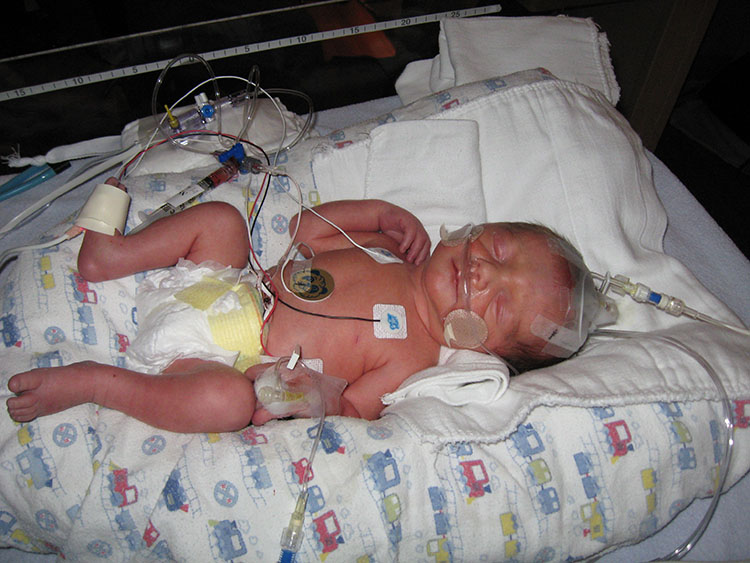 Baby Colby Hedin