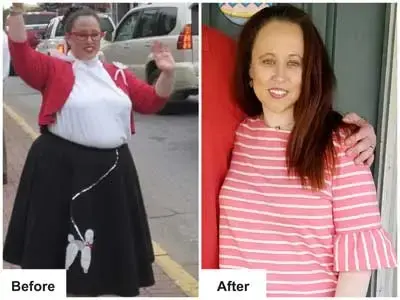 Nichole before and after weight loss surgery.
