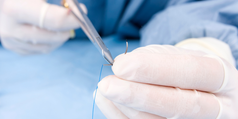 A pair of hands using a clipper to cut surgical thread.