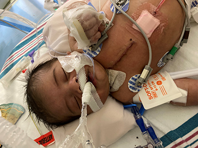 Malachi after surgery.