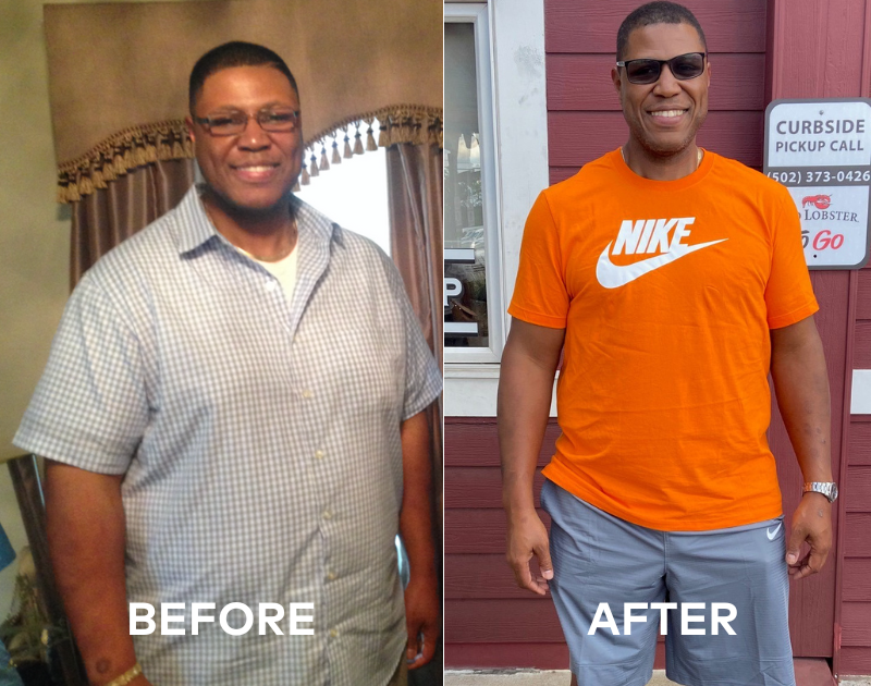 Ronald before and after his weight loss surgery.