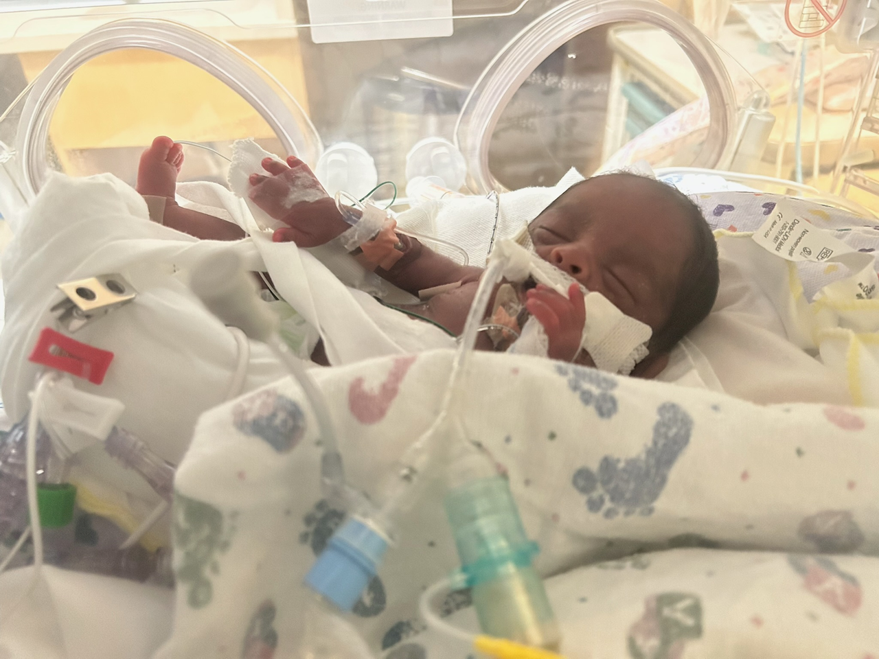 Phillip is growing in NICU