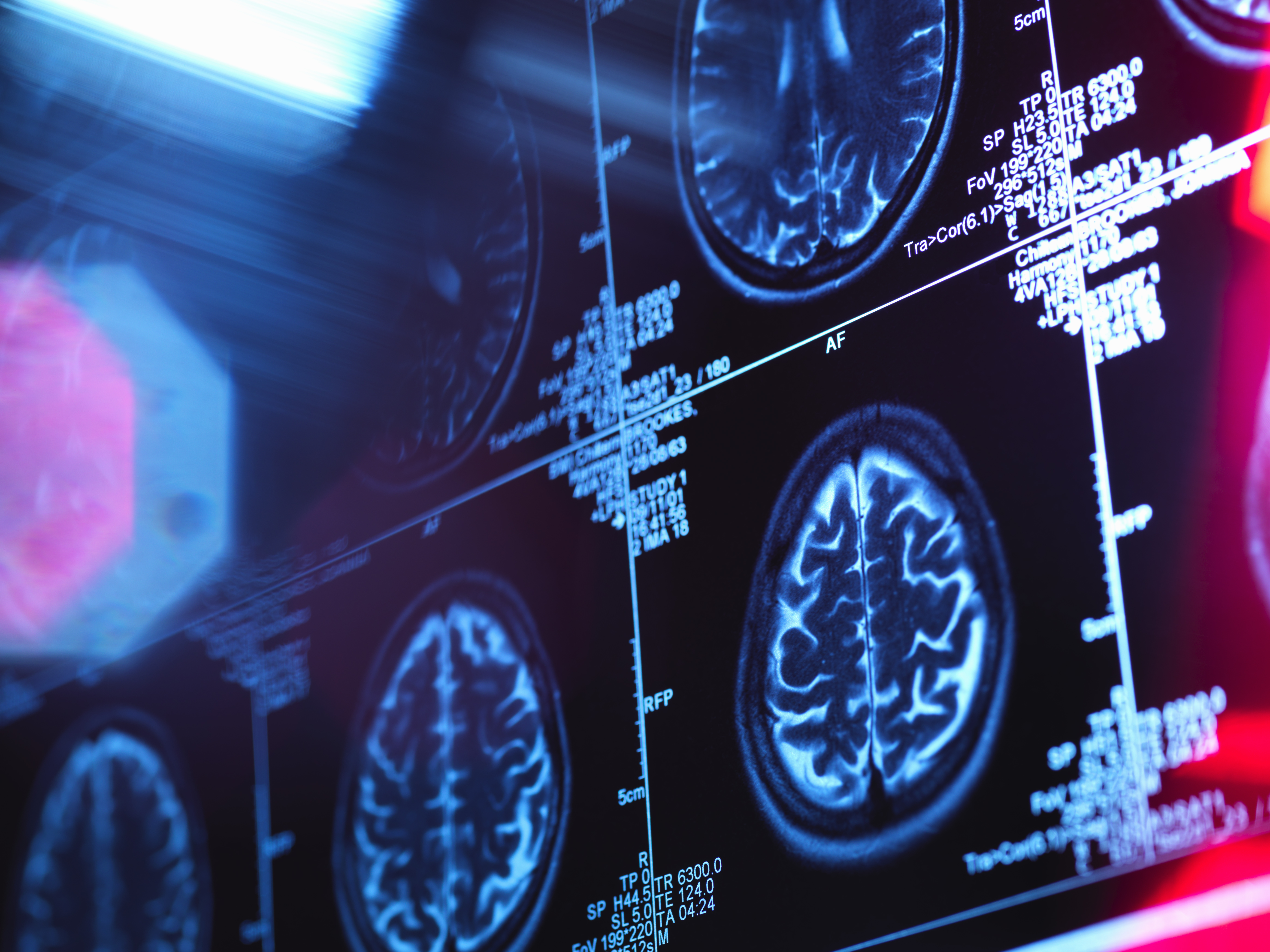 Human brain scan results.