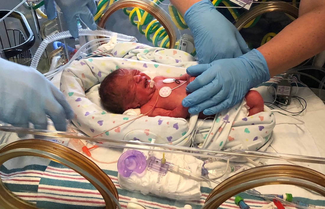 Bo Marvin in NICU right after birth