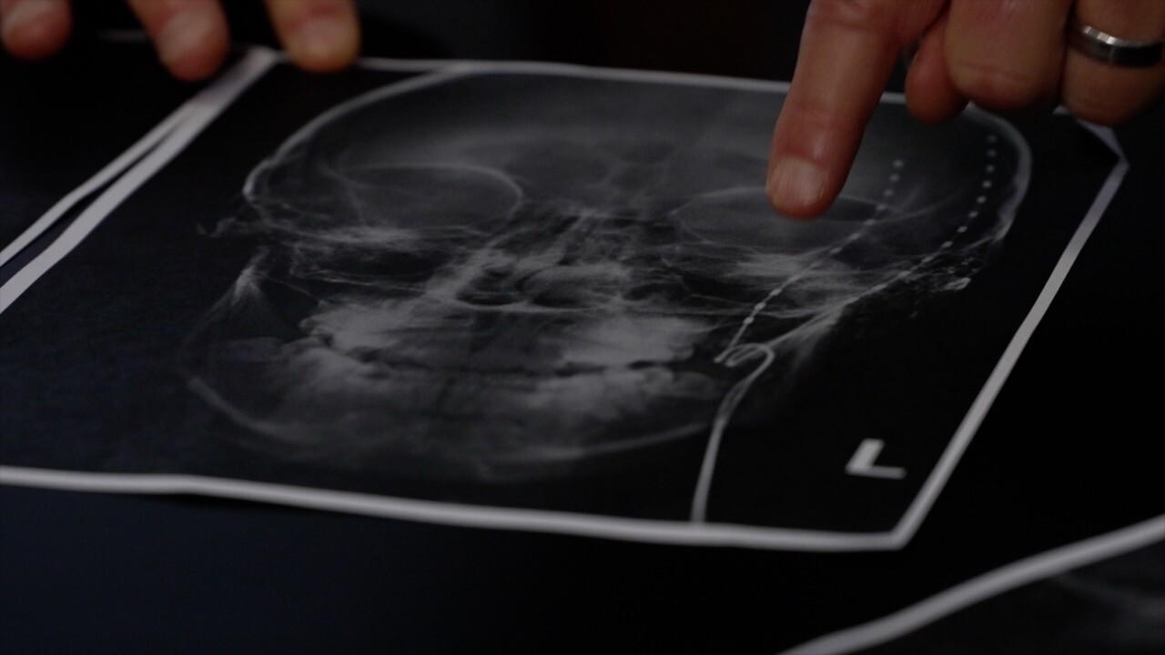 An X-ray of the head.