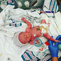 A newborn baby in a nurses hands.