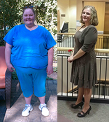 Carrissa Clark before and after weight loss surgery.