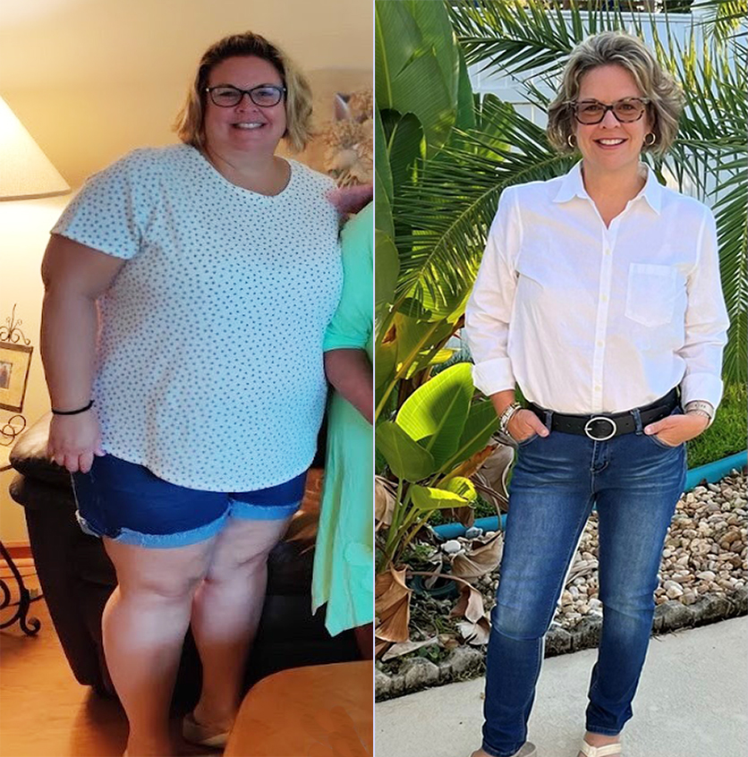 Sheila Oben (Before & After)