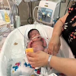 Amaris Lourdes Arredondo being treated in the NICU