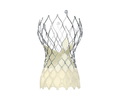 A transcatheter aortic valve.