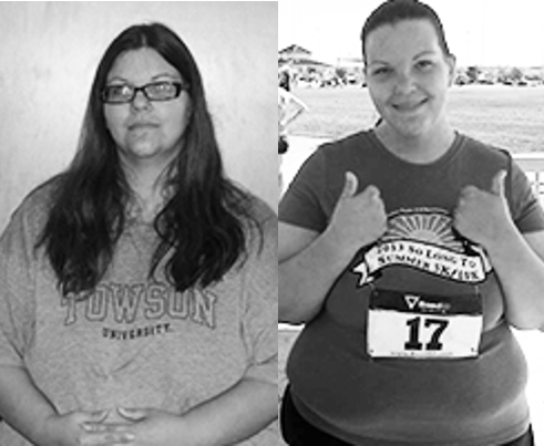 Maria before and after weight loss surgery.