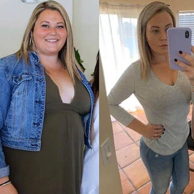 Cassidy S. Before and After