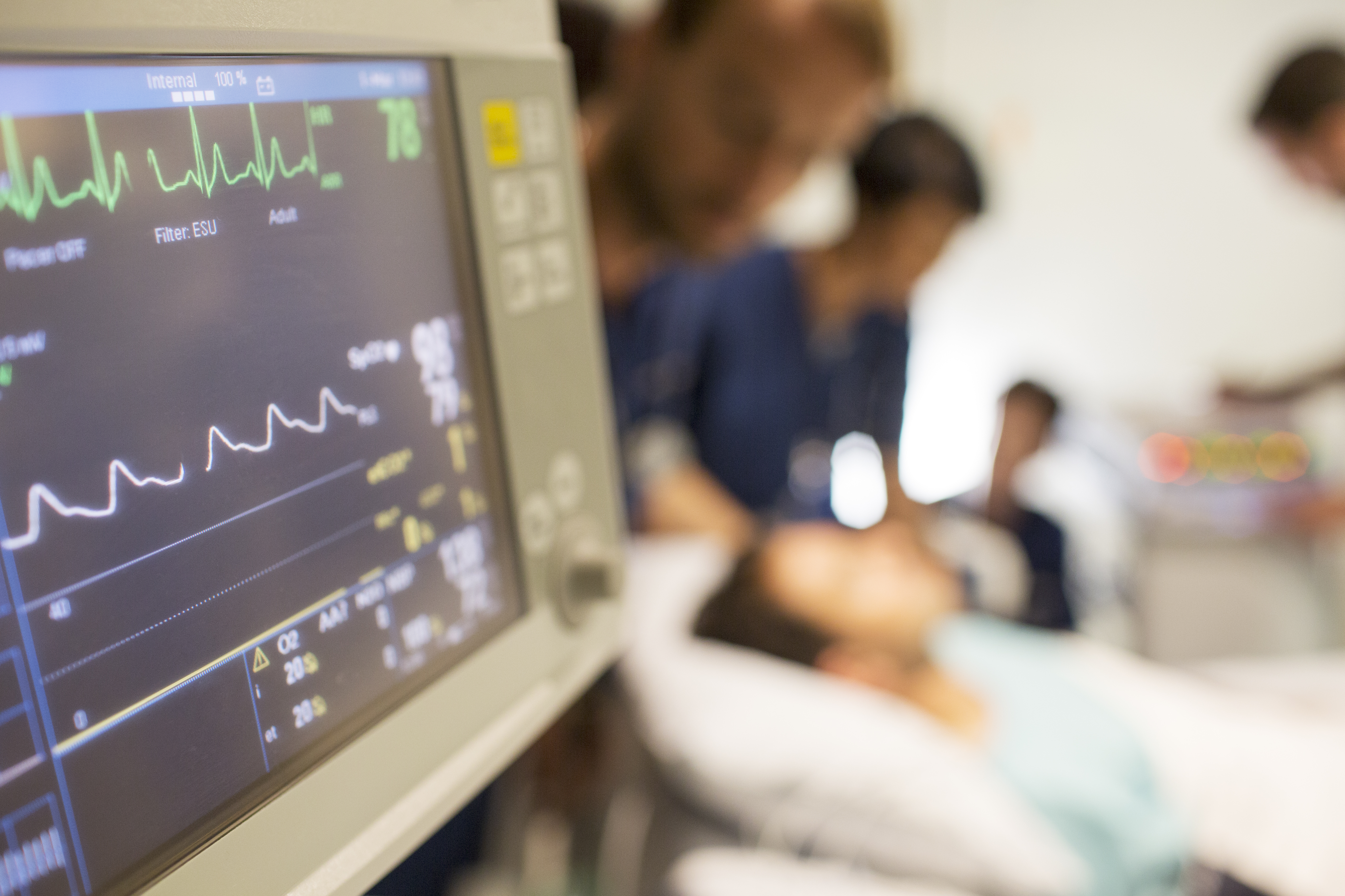 Heart monitoring technology with out-of-focus patient and care team members in the background.