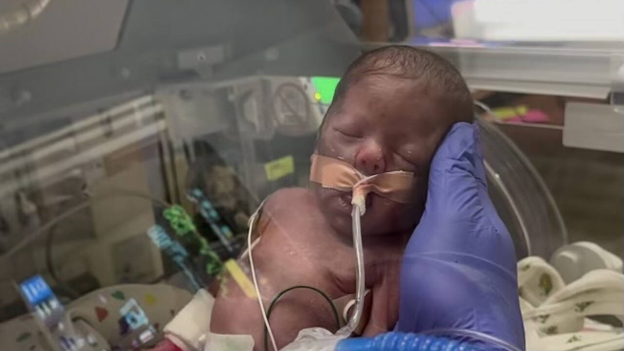 Nico, born premature and given care at Rocky Mountain Children's.