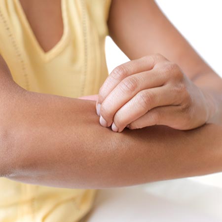 A closeup of a person scratching their arm.