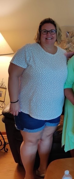 Sheila Oben before bariatric surgery