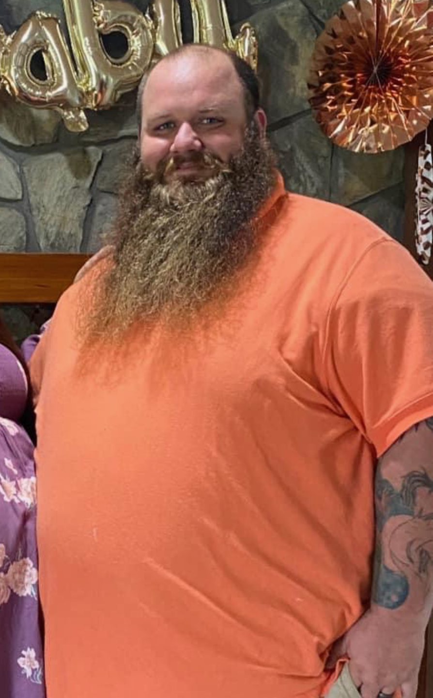 Man stands smiling before his bariatric surgery.