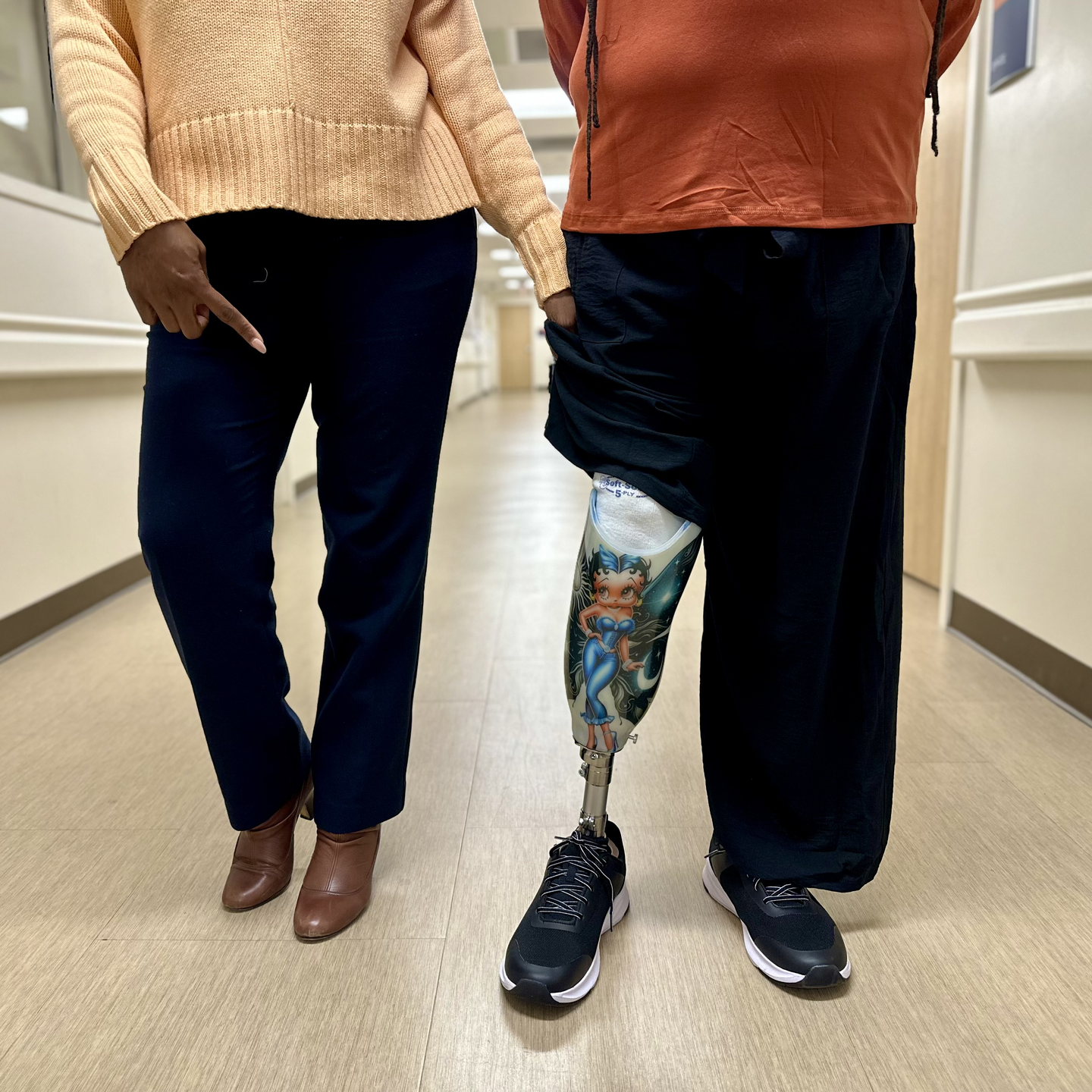 Patient receives specialized prosthetic training after a right below-knee amputation.