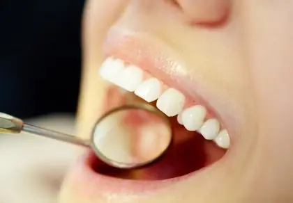 Dental mirror being held inside a persons mouth looking at their teeth.