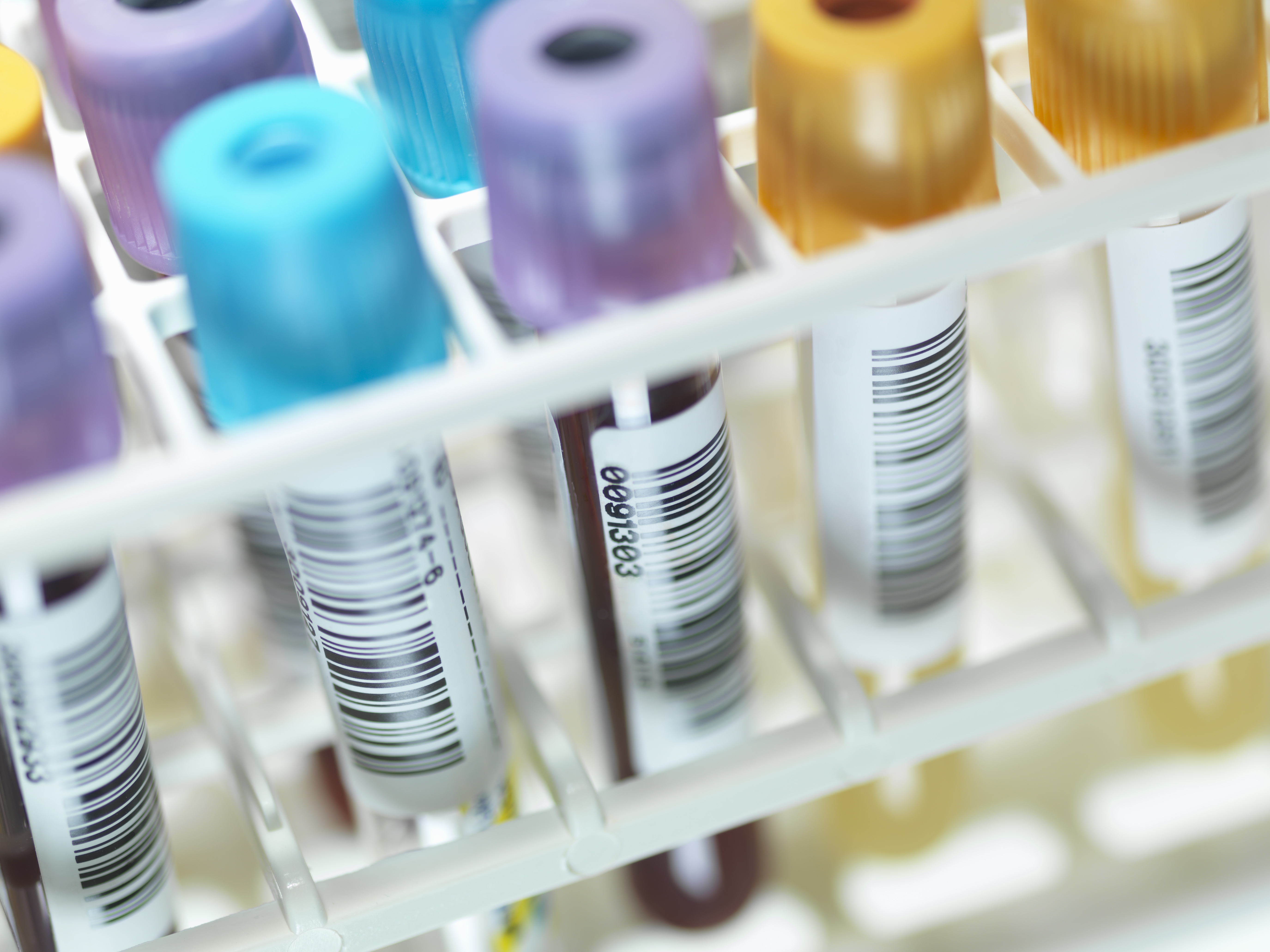 A row of human blood and chemistry samples awaiting testing in the lab.