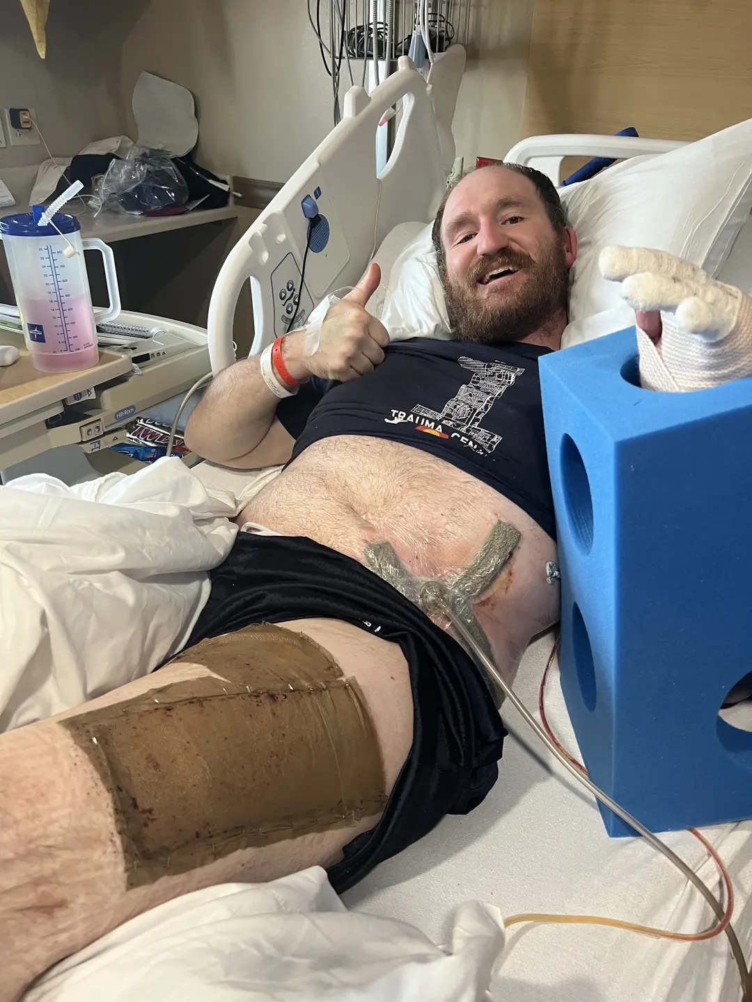 Nic Pax in bed in good spirits after seeing flap results