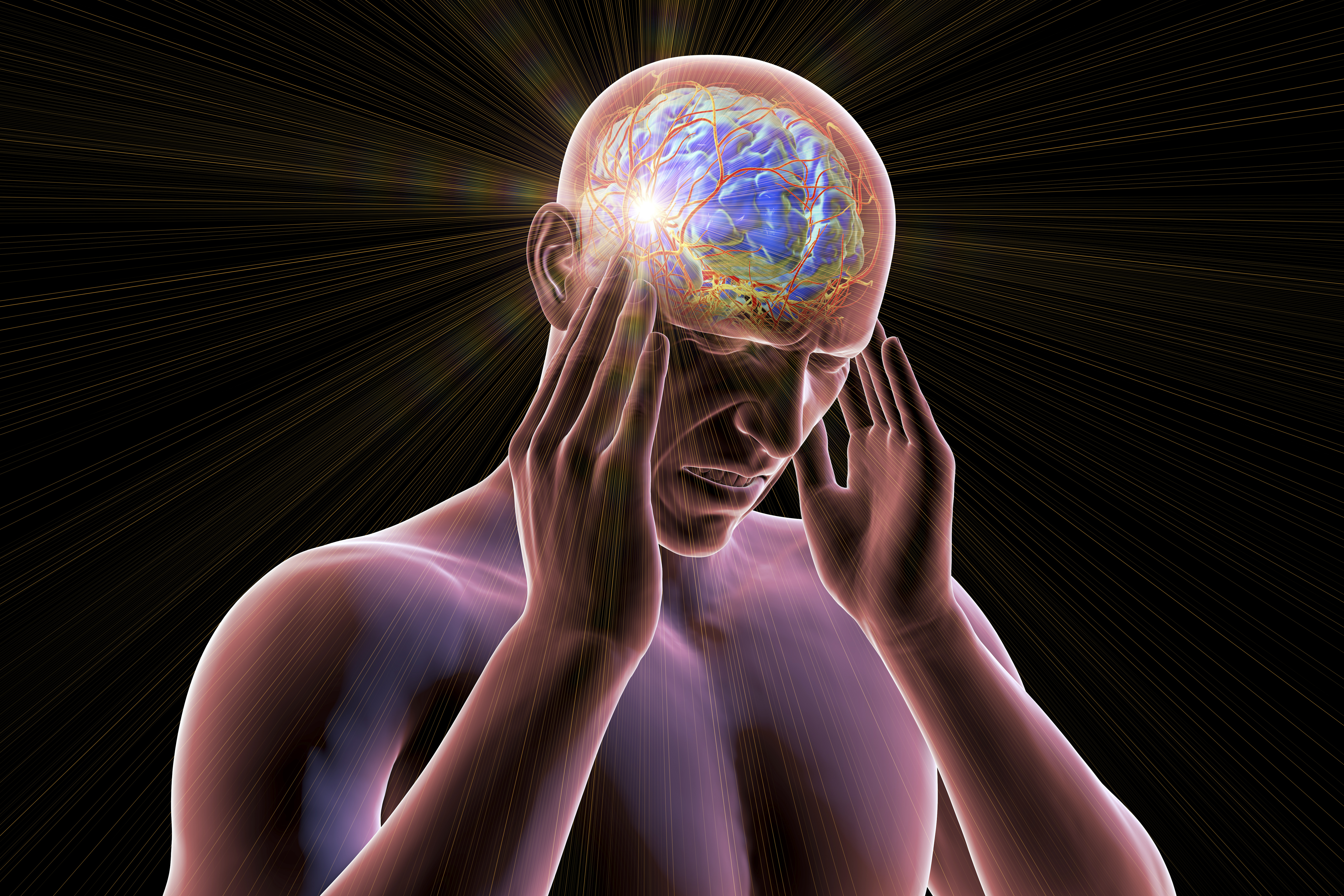 Illustration of a person experiencing a headache