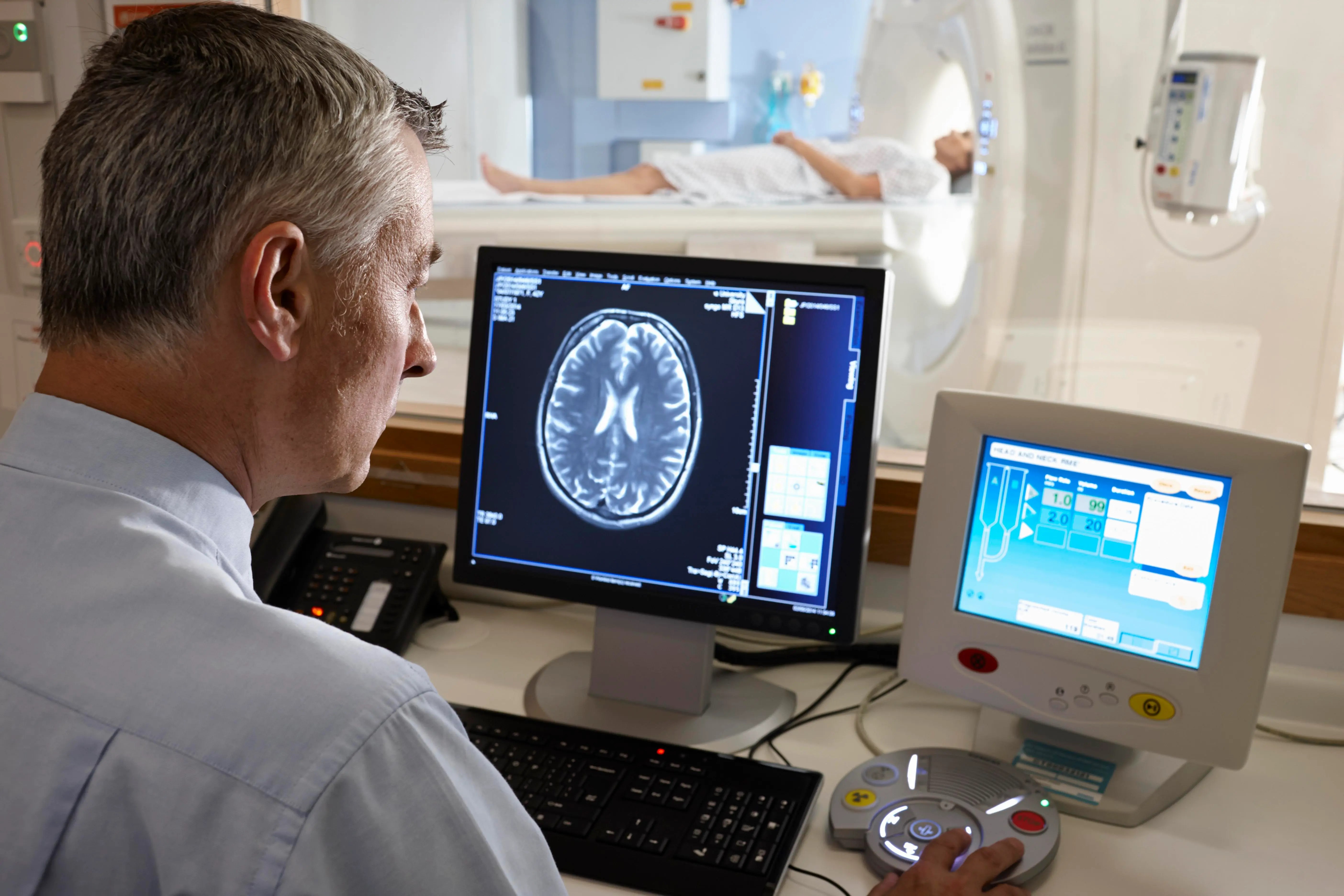 A male doctor examines a brain scan